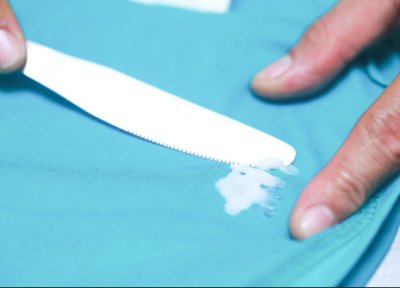 پاک کردن لکه شمع از روی پارچه پاک کردن لکه شمع از روی پارچه